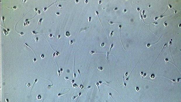 Anton van Leeuwenhoek