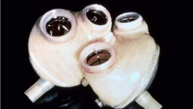 Primera implantacion de un corazon artificial en un ser humano.