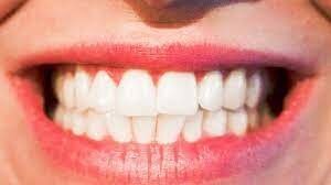 Odontologia Estetica