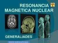 resonancia magnética nuclear