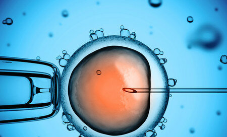 Fertilizacion in Vitro