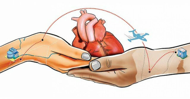 Transplante de organos