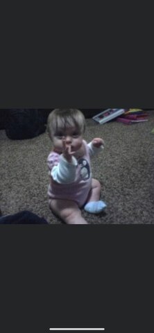 When I got pyloricstenosis surgery