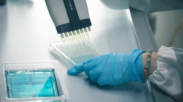 Development of ELISA Test to Screen for Diseases Such as HIV