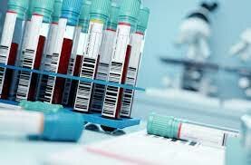 Scientists Begin Developing Blood-Screening Tests for Infectious Diseases