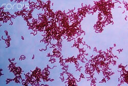 Rodospirillum rubrum