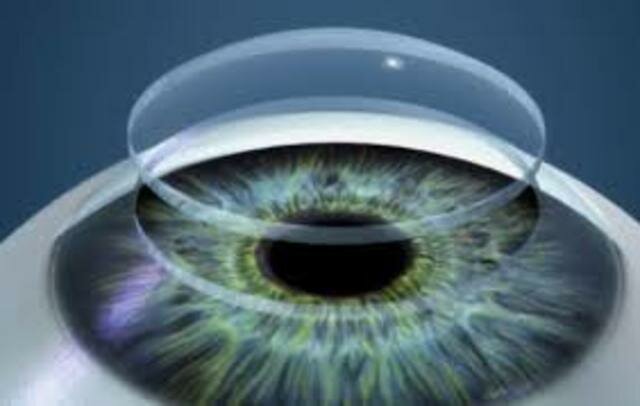 Implante PMMA en cirugia Ocular