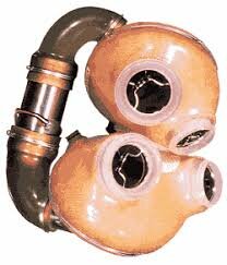 Implante del primer Marcapasos