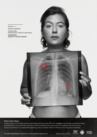 Epidemiology of Smoking/Lung Cancer