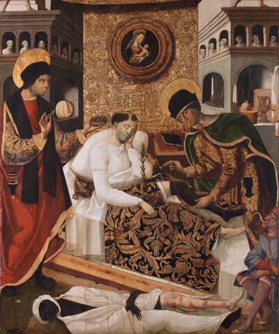 Trasplante de Órganos