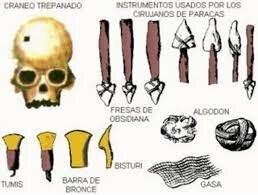 primeras evidencias de trepanaciones