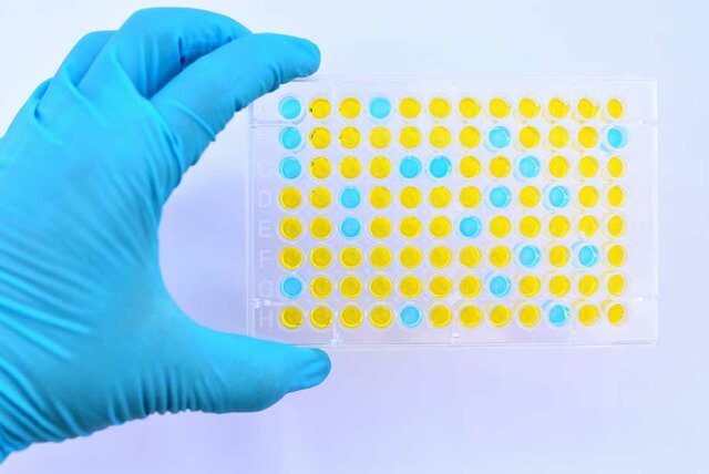 ELISA Test
