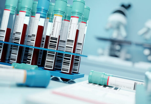 Creating Blood-Screening Tests