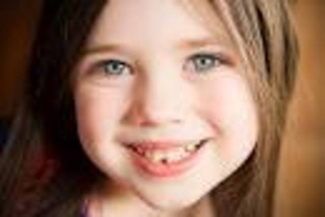 Lost first baby tooth/Abri