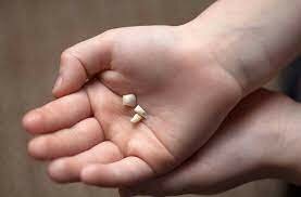 ES CAU LA MEVA PRIMERA DENT