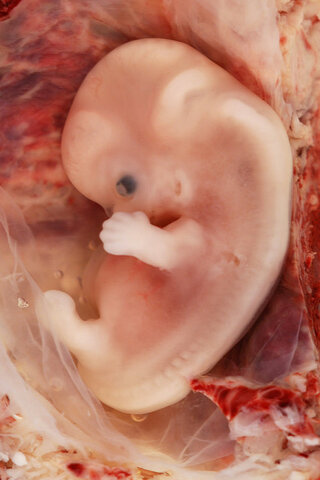 prenatal development week 3