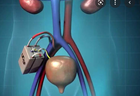 1943 Artificial Kidney
