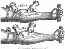 Transfusión de sangre