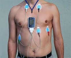 EL MONITOR HOLTER
