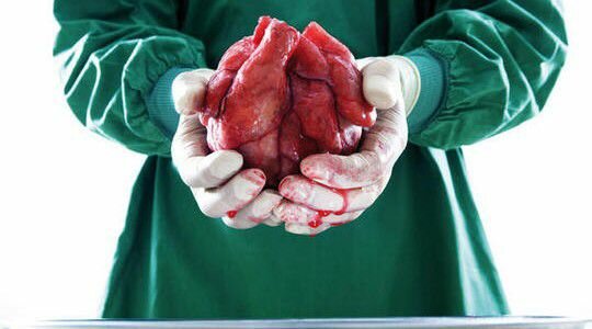 trasplante de corazón entre humanos