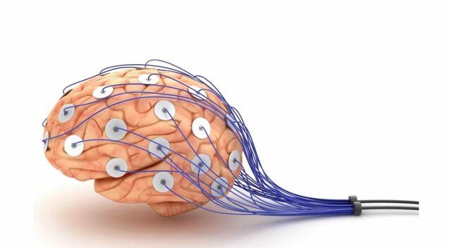 Electroencefalograma