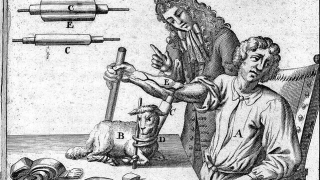 transfusión de sangre