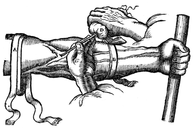 Primera inyeccion en sangre