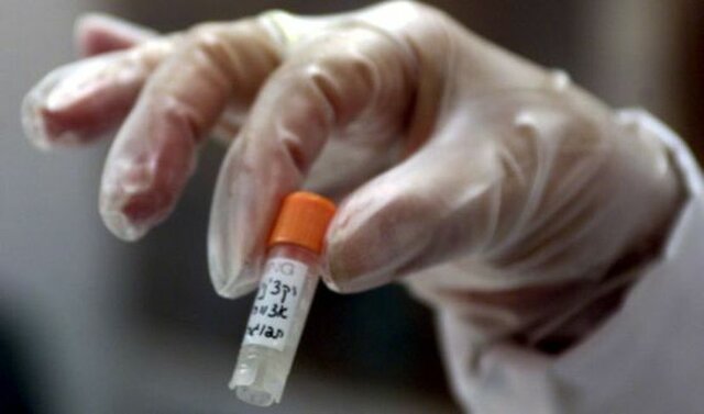 Vacuna para la viruela