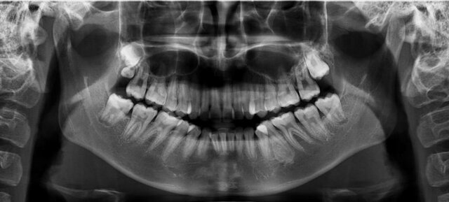 Descubrimiento de los rayo x