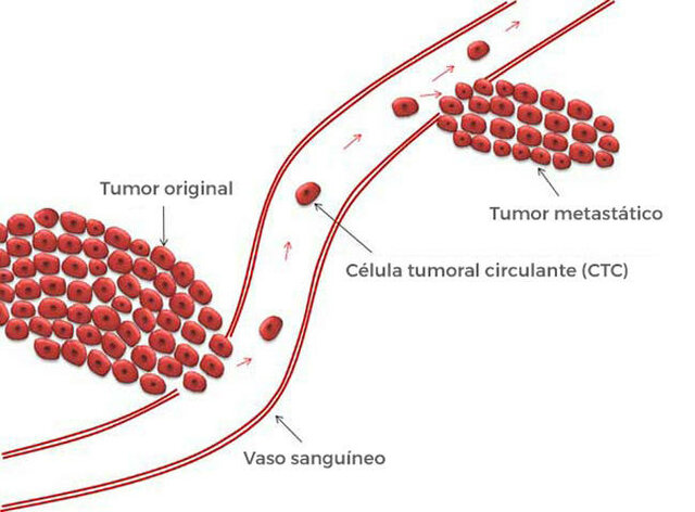 Biopsia Líquida para el Cáncer