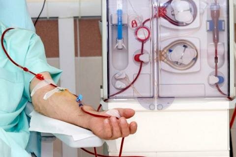 Desarrollo de la diálisis para la insuficiencia renal