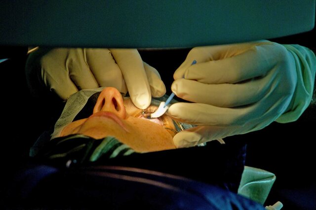 Primera cirugia de trasplante en seres humanos