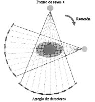TAC's de segunda generación