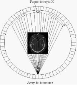 TAC's de cuarta generación