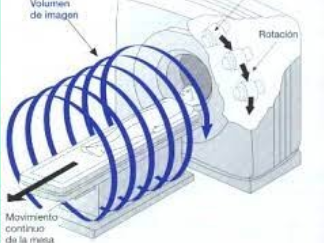 Equipos helicoidales