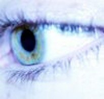 Primera cirugía (trasplante de cornea)