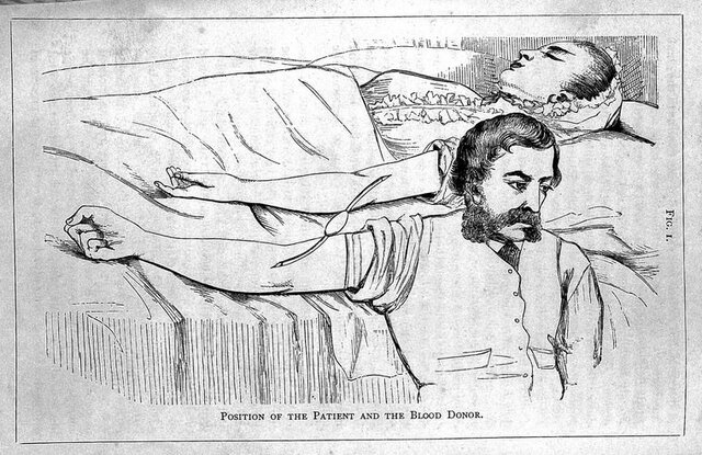 First blood transfusion performed.