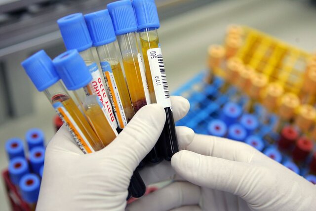 Scientists began developing blood-screening tests for infectious diseases.