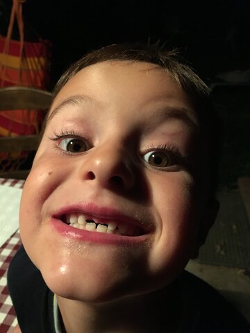 Em cauen les primeres dents