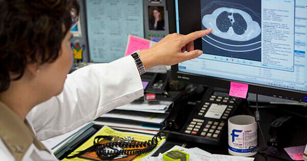 Inmunoterapia para tratar el cáncer