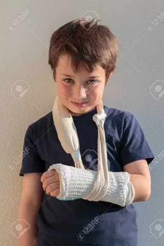 em vaig trencar el braç