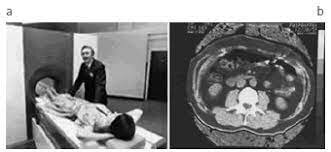 Primera TC de cuerpo completo