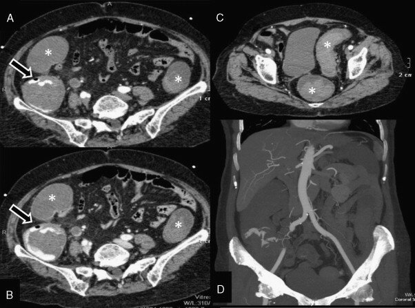 Introducción de la tecnología de multidetectores