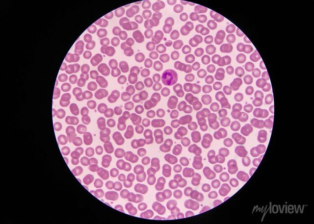 First blood microscope observation