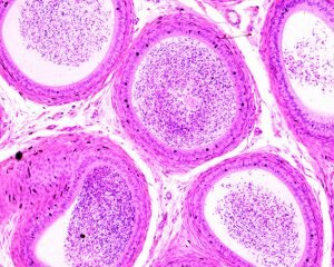 TIPOS DE MUESTRAS QUE SE PUEDEN OBSERVAR