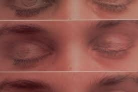 MOR- movimiento oculares rapidos  en sueño - 1994,2006