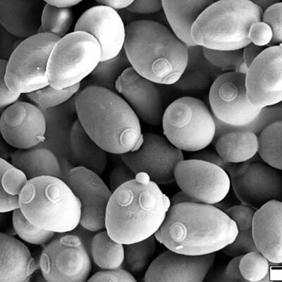 Timeline: A levedura Saccharomyces cerevisiae na modernidade