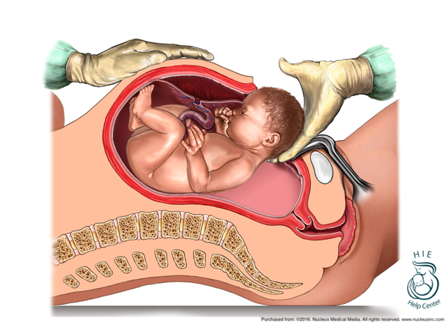 Birth Through Two Weeks