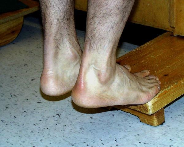 Athlete 1- repair stage