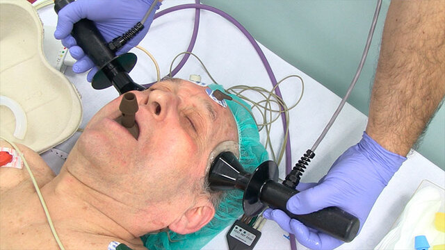 Un precursor del electroshock